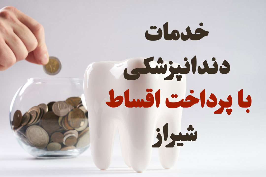 خدمات دندانپزشکی پرداخت اقساط شیراز عصب کشی اقساطی ترمیم دندان بلیچینگ دندان لمینت دندان زیبایی جراح روت کانال خدمات ترمیمی قسطی
